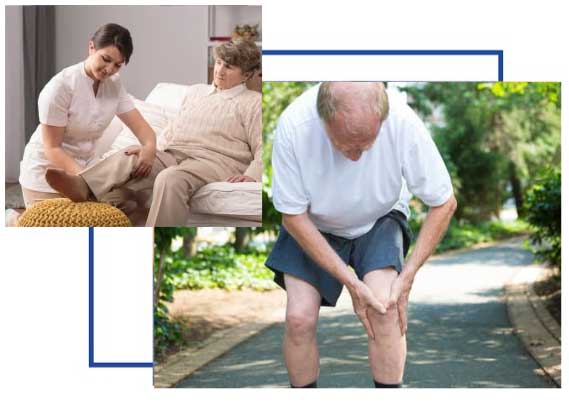 Osteoarthritis of the knee clinical research trial
